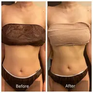 人気No1✨スピード痩身♪ マシン3台使用がっつり痩せ150分53900円→26800円