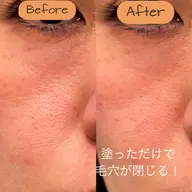 ファーマリジェネプレミアムインテンシブコース　25000円→12000円‼️