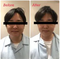 💎光フェイシャル💎リフトアップ⤴️+毛穴・くすみケア💎透明感UPで素肌美人へ✨🎀¥15980→3980