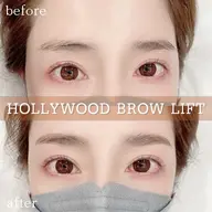眉毛とまつげのお悩み解消！一気に垢抜け♪ハリウッドブロウリフト＋ケラチンラッシュリフト