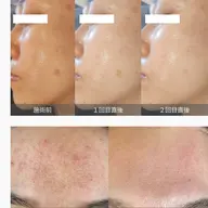 《韓国肌管理フルケア》ダクトピール×LDM