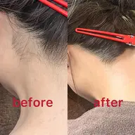 ミニモ限定【うなじツルスベワックス脱毛&最新THR光脱毛】メンズOK！