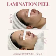 《ミニモ学割》U24  ラミピール×モデリングパック◇次世代ピーリング|剥離なし