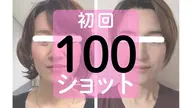 【2回目以降】シワ・シミ・くすみ・たるみから薄毛まで、お顔と頭皮のケアに 100ショット