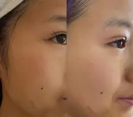 フェイシャルエステ初回500円!