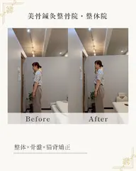 【反り腰▪️姿勢改善】骨盤矯正×姿勢矯正×整体×EMS