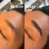 ハリウッドブロウリフト