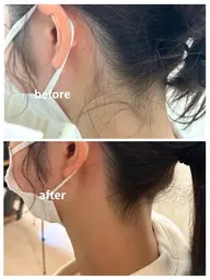 【学割U-24】春まで垢抜け！つるすべうなじ脱毛　4,500円→2,200円