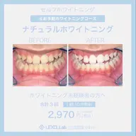 【初回限定】自然な歯本来のピカピカの白さを目指していきます😁〈30分照射コース〉