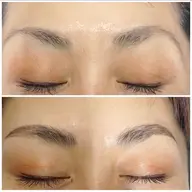 ハリウッドブロウリフト