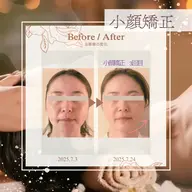 ◉初回限定　小顔矯正（速攻リフトアップ）＋　毛穴洗浄　むくみケア/エラ張り/毛穴ケア