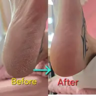 フット角質除去ケア(別メニューと同時の場合1,500円で特別提供)