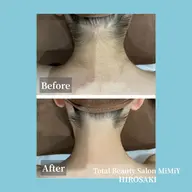 後ろ姿に自信◎うなじ脱毛【女性】60分