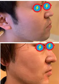 need(制毛器)体験