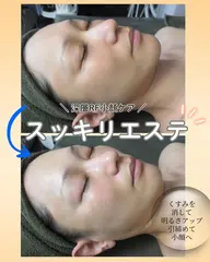【小顔・引締め・スッキリしたい方】【期間限定】深層小顔ケア90分