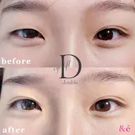 【ご新規様 】ダブルアイリフト