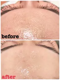 お顔✩襟足✩肩から肩甲骨下辺りシェービング