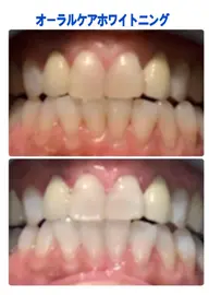 【リピーター様OK】オーラルケアで清潔感UP✨
