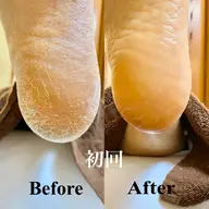 フット角質ケア👣赤ちゃんのようなモチモチ足裏に✨スパルーチェフットケア🌈