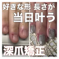 深爪矯正【長さ出し】◆ﾗﾒ/ｸﾞﾗﾃﾞｰｼｮﾝ◆(オフ込)むしったり 割れたり 噛んで小さくなった爪も綺麗な状態に✧︎