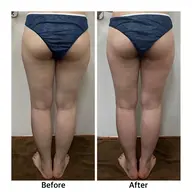 Open価格✨【むくみ撃退スッキリ美脚60分】