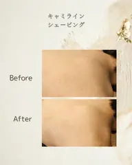 【背中と二の腕】オフショルライン&アームシェービング