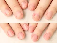 深爪矯正長さだし １カラーorグラデーション