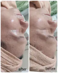 温活エステ♨1年中使える琥珀オイル美容液使用✨ハリ・弾力・保湿感が得られる！　乾燥肌の方にオススメ