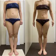 🔥本気痩せ×全身フル痩身🔥《5980円→2980円》1台でW効果✨