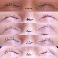 ラッシュアディクト★まつ毛育毛‼︎