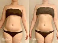 ※スタッフ🈯️⏰人気No.1メニュー✨🉐【短期間でサイズダウン🔥】全身痩せ90分コース