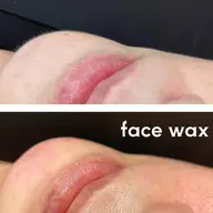 フェイスワックス+ハイドロ炭酸パック🫧