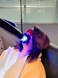 セルフホワイトニング 初回(8min✖️2照射)