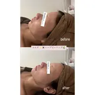 [人気No.1❤️‍🔥] Reviハーブ2g✖︎小顔コルギ(デコルテリンパ付)90分