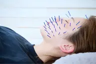 13日限定❄️美容鍼80本コース《冬の集中保湿美肌ケア》お顔の土台から整え、血色アップ小顔＆うるツヤ肌