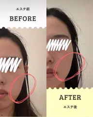 【5/1​〜​5/6限定】フェイシャルリンパマッサージ