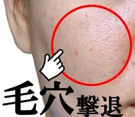 毛穴レスたまご肌🥚✨