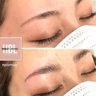 ハリウッドブロウリフト