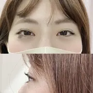 🦄まつげカール上下施術です🦄