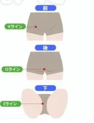 メンズ脱毛 VIO どうしても無くならない◯◯の裏とか。しっかりケアしましょう!