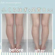 【ミニモ限定】太ももorふくらはぎ集中お試し90分