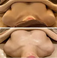 【人気手技No.1】バストアップ育乳90分/全身+バスト+泡パック+バンテージ ¥25000→¥6000