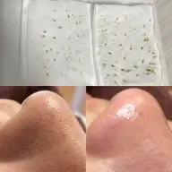 【ご新規様限定】新メニュー！二刀流毛穴エクストラクション（鼻）