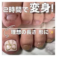 フット深爪矯正【長さ出し】◆アート×2◆(オフ込/フットバス付) むしったり 割れたり 小さくなった爪も綺麗な状態に✧︎