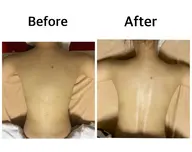 ボディーオイルマッサージ60分＋選べるオプション15分（足裏・顔・デコルテ・肩甲骨剥がし・ドライヘッドスパ）計75分