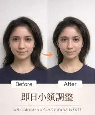 小顔矯正✨【ドライヘッドスパ×小顔矯正】効果→リフトUP・たるみ・シワなど！