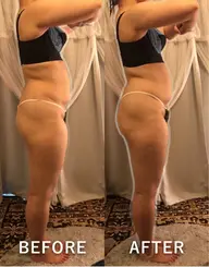 【極楽氣分のダイエット施術体験】1回目から引き締まる.引き上がる！？内臓下垂へのアプローチ・極楽筋膜リリース・排出体質へ