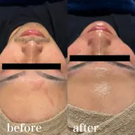 【男性】フェイシャル前顔