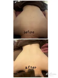 オールハンドの痩身リンパマッサージ90分