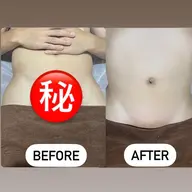 ✨ミニモ限定価格✨メンズ ブラジリアンワックス  VIO  WAX脱毛 鎮静クリーム付き ¥5500